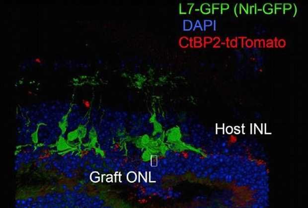 Merging of transplant and recipient retinal cells. In green, recipient cells; in red, cells from transplanted tissue. Photo: Mandai et al./Stem Cell Reports 2017 / press materials